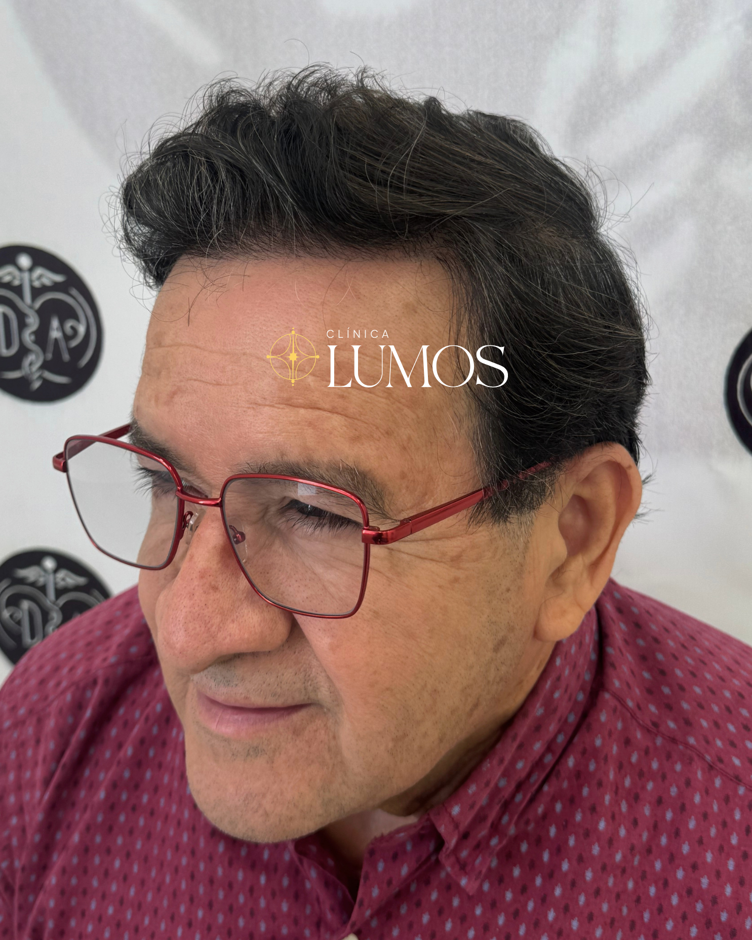 paciente-feliz-trasplante-capilar