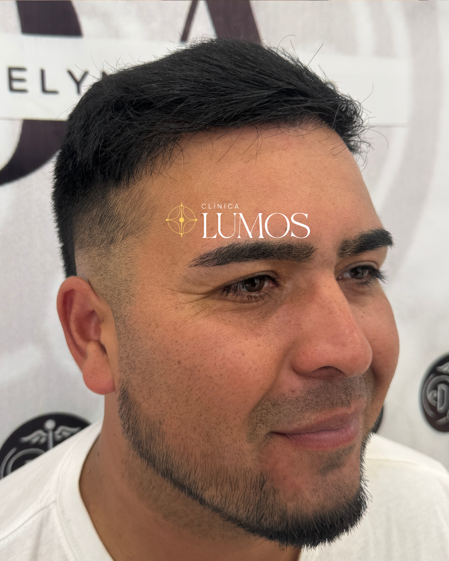 clinica-capilar-cercana