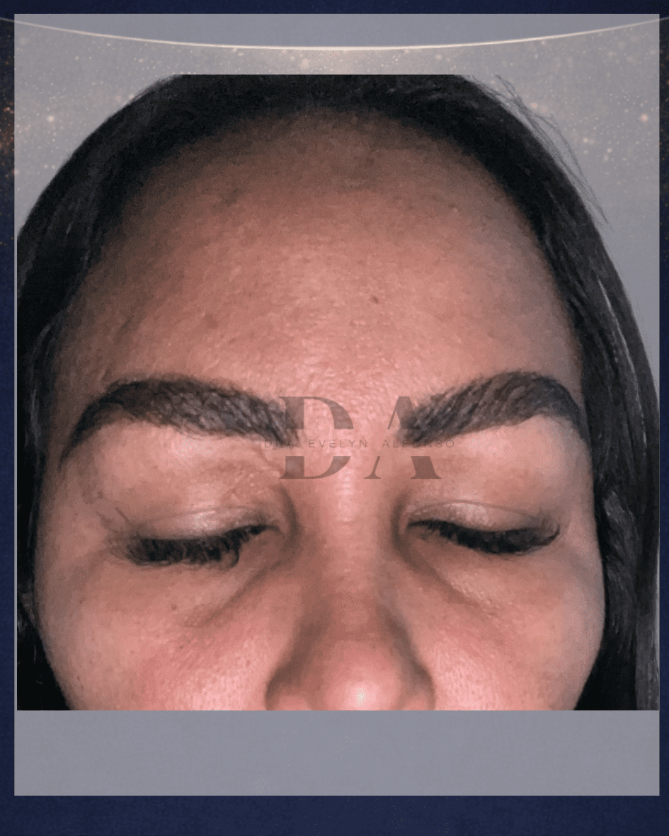 despues-de-un-trasplante-de-cejas