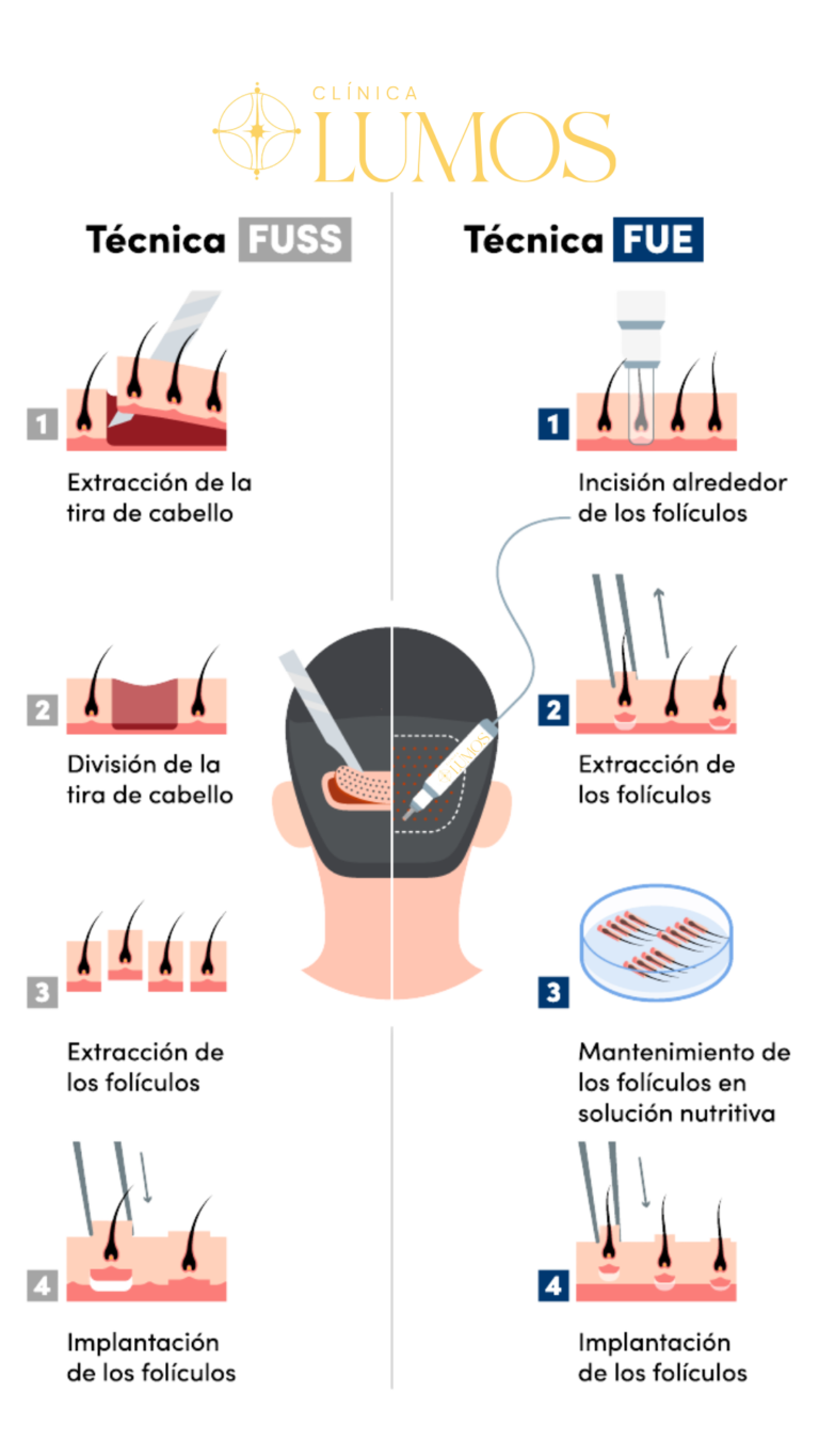 técnica fue vs la técnica fuss