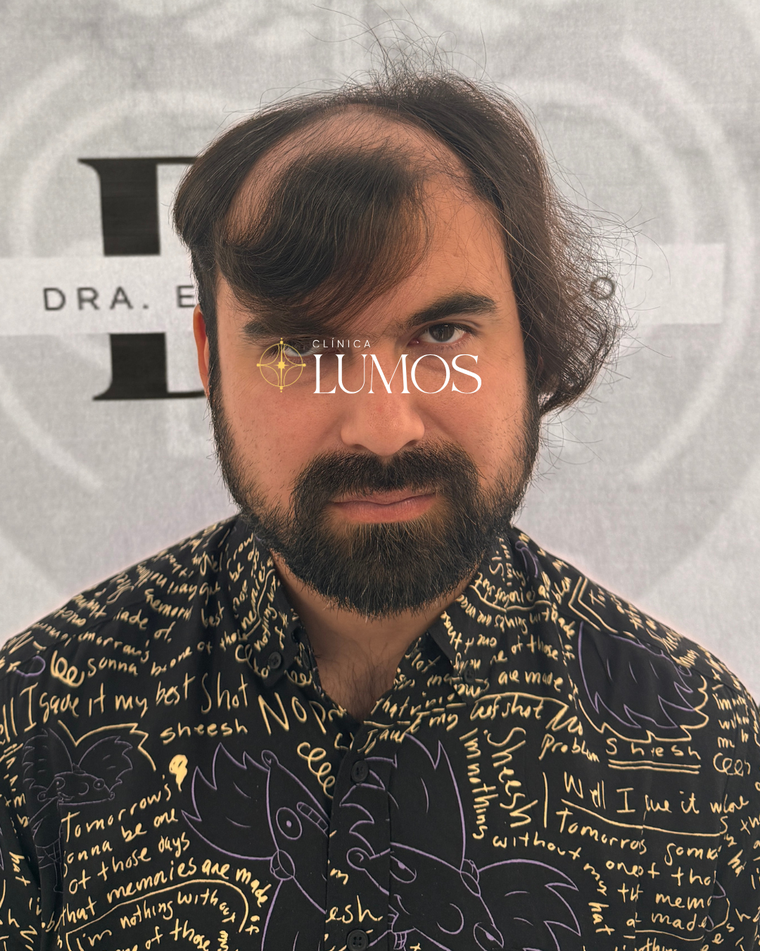 Hombre con cabello y barba oscura