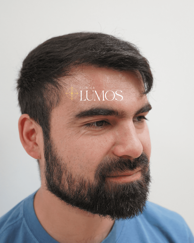 Hombre con cabello y barba bien cuidados.